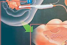 必看！泰国三代试管成功率，助你实现生育梦想！